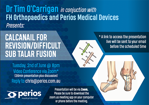 Dr O'Carrigan Presents a Webinar on Subtalar Joint Fusion Using a Calcaneal Nail