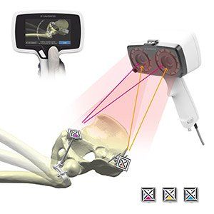 Total Hip Replacement